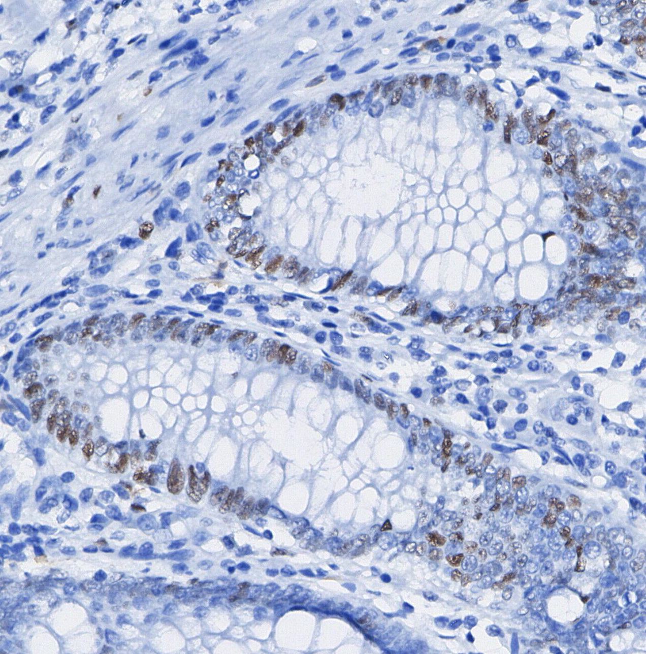 CDK7 Antibody