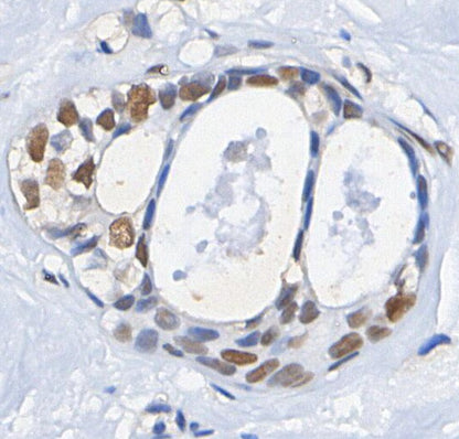 IRF-8 Antibody