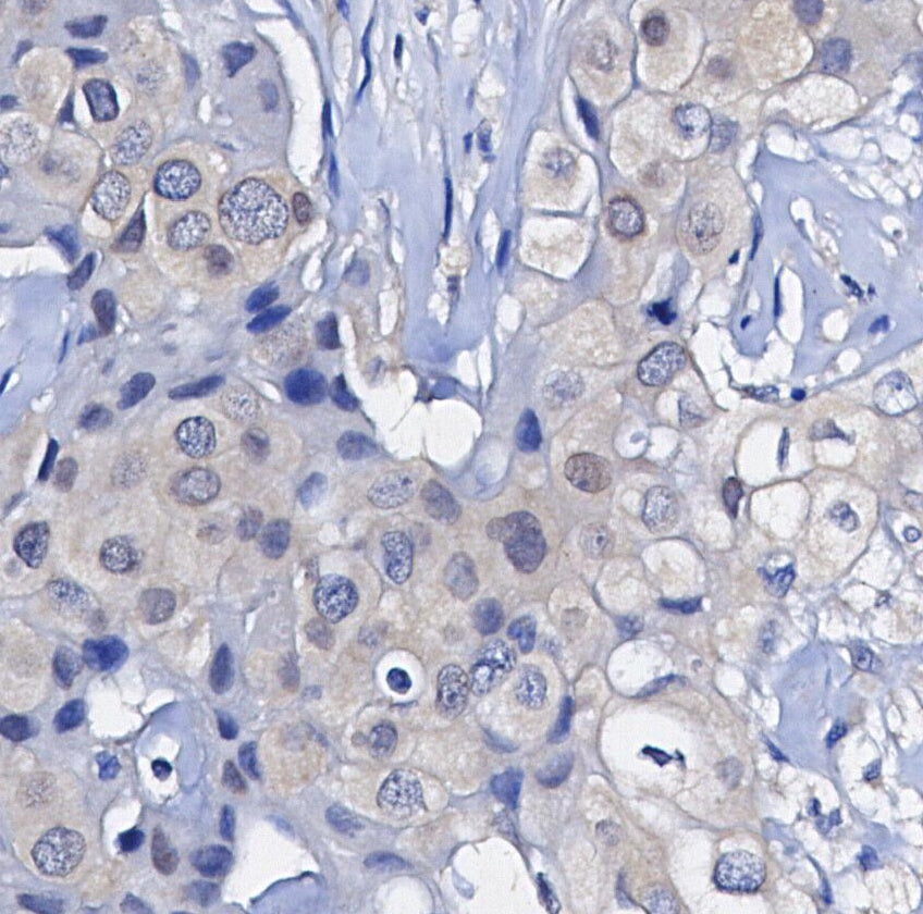 Phospho-p90 RSK (Thr359) Antibody