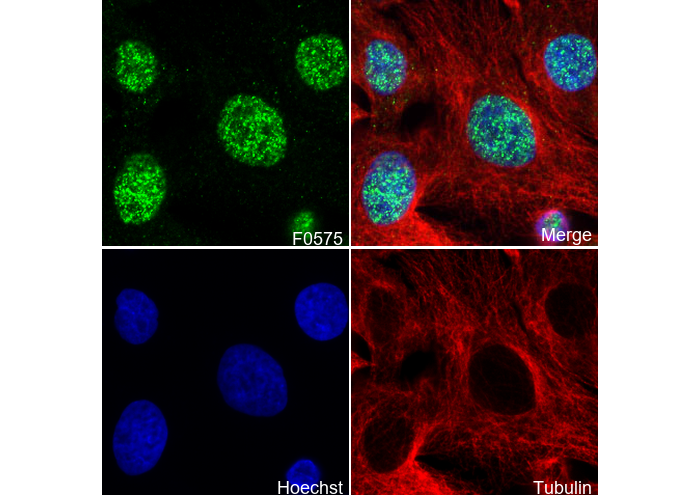 HMGA2 Antibody