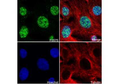 HMGA2 Antibody