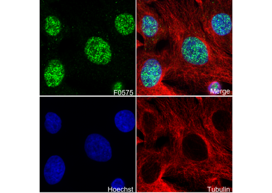 HMGA2 Antibody