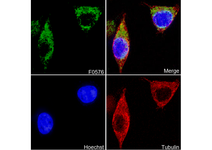 IDH1 Antibody