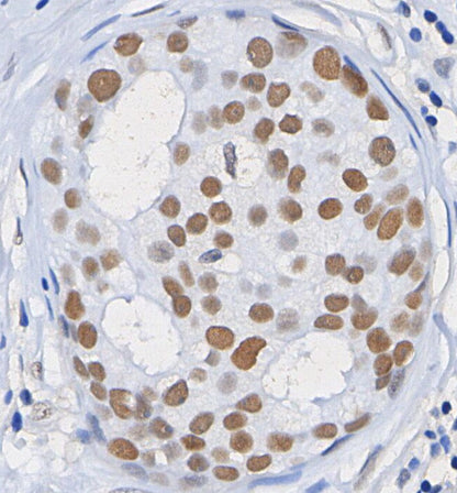 JunB Antibody