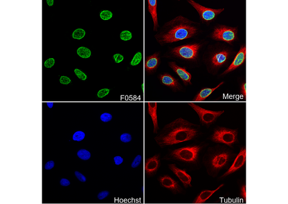 NUP98 Antibody
