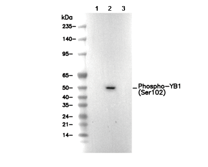 Phospho-YB1 (Ser102) Antibody