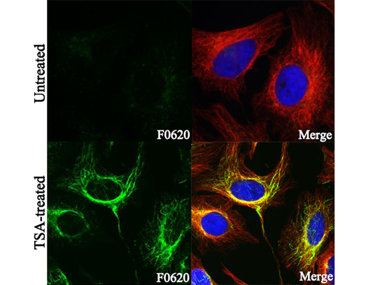 Acetyl-α-Tubulin (Lys40) Antibody