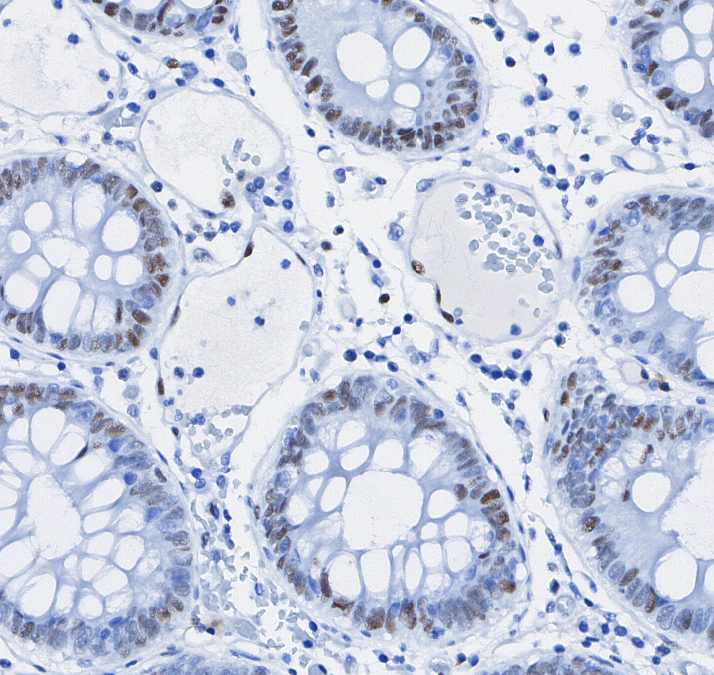 HIF-1β/ARNT Antibody