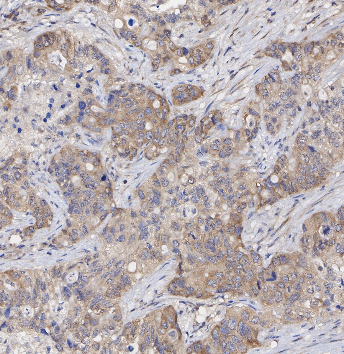 eIF3A Antibody