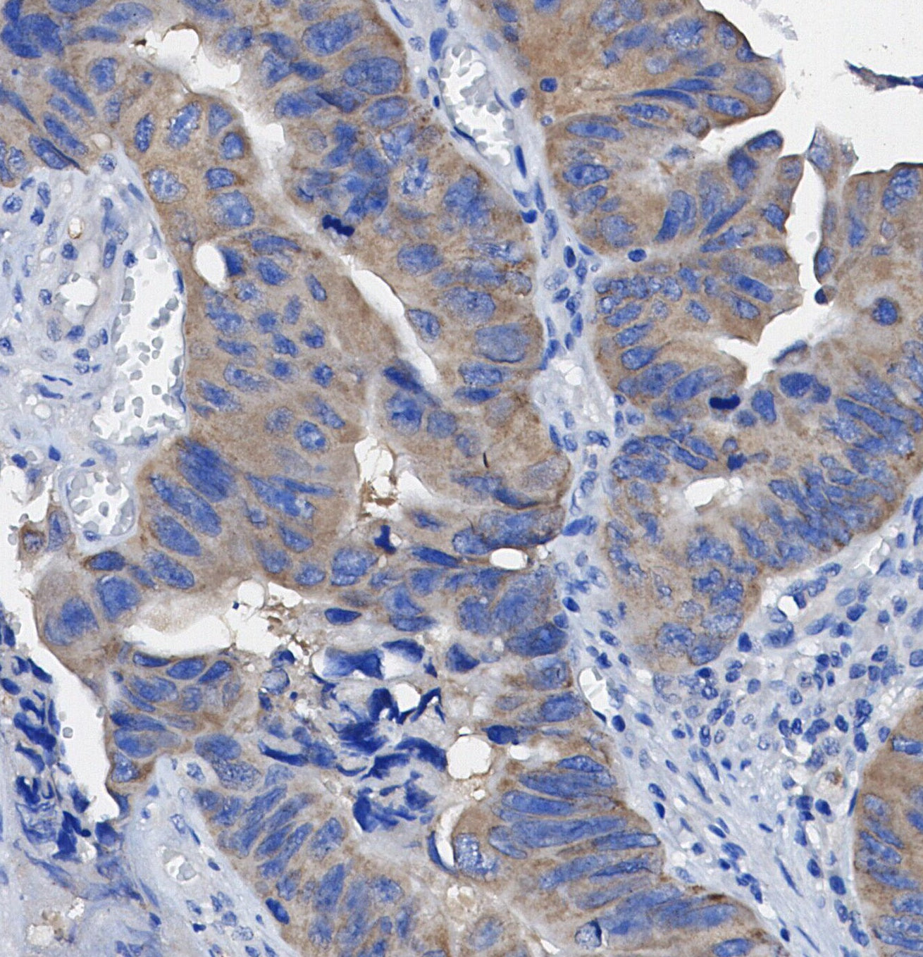 β-Arrestin 2 Antibody