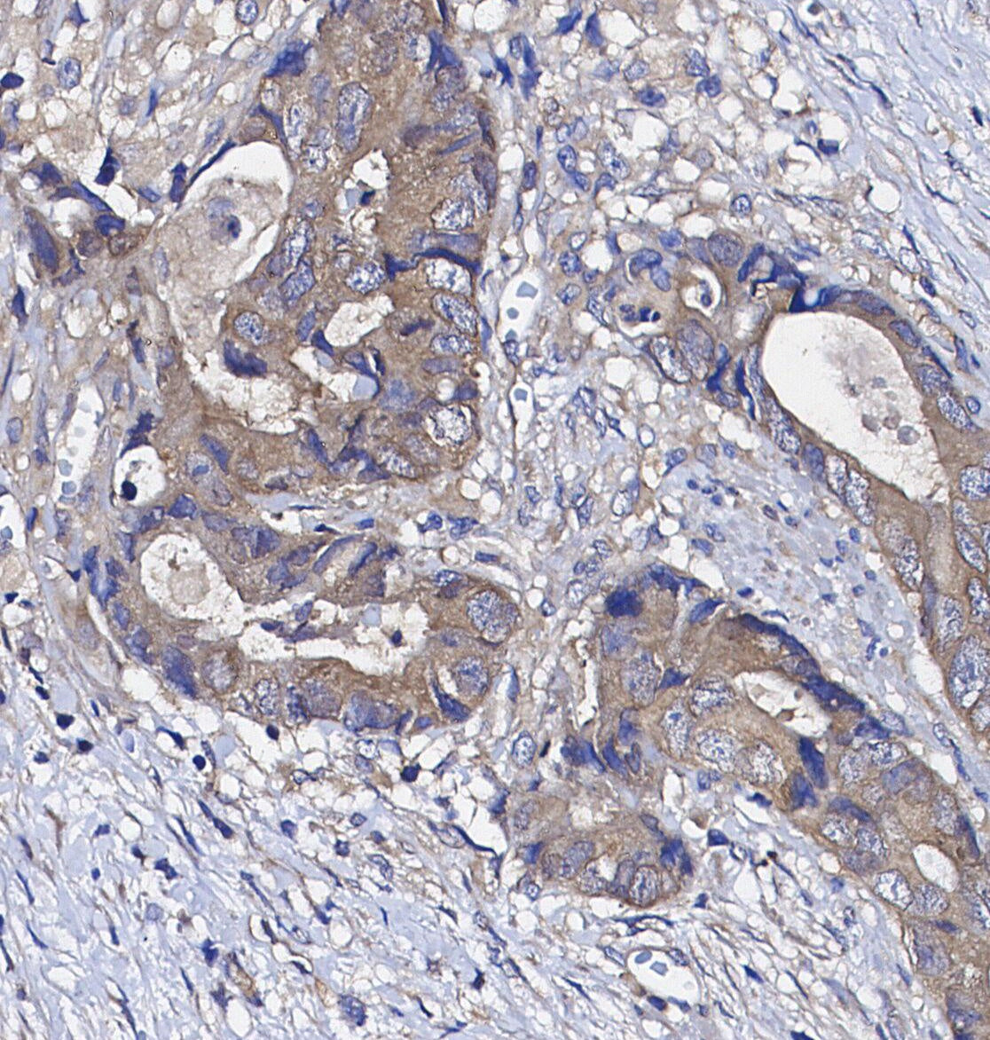 DEPTOR/DEPDC6 Antibody