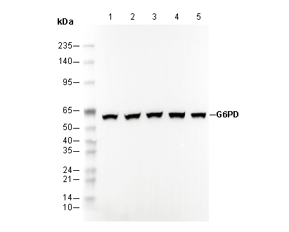 G6PD Antibody