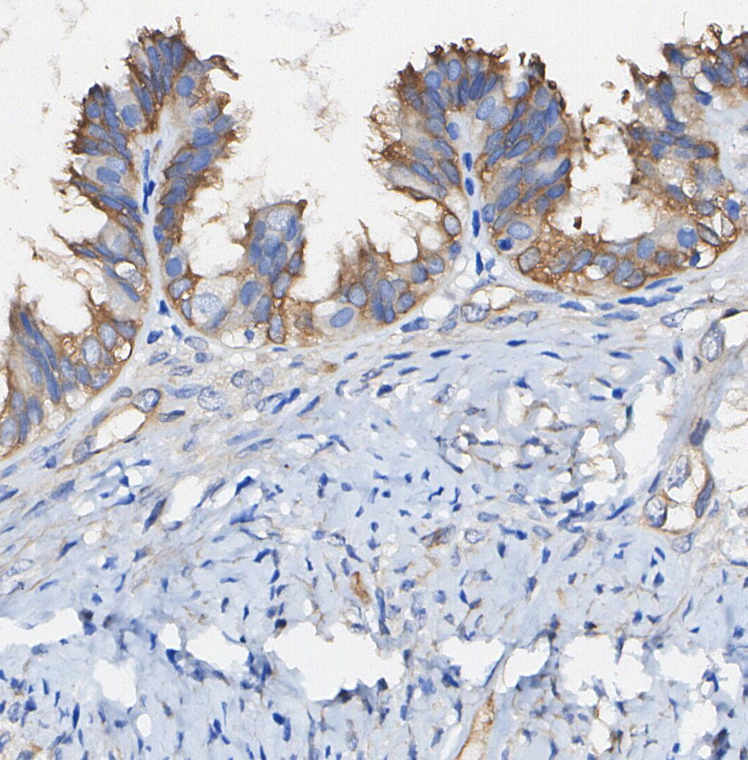 MYPT1 Antibody