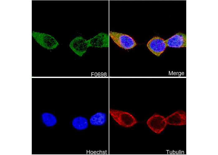 PFKP Antibody