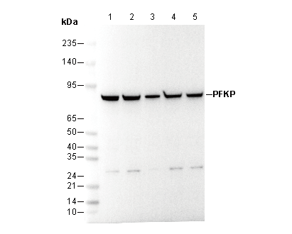 PFKP Antibody