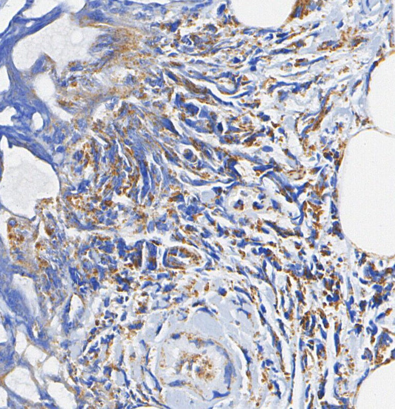 PODXL Antibody