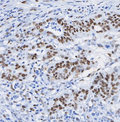 Vitamin D3 Receptor Antibody
