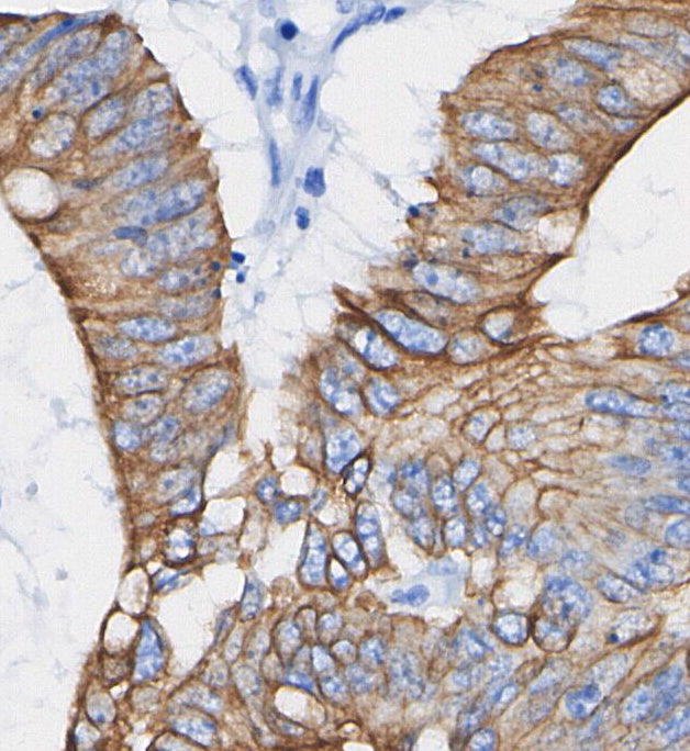 CEA/CD66e Antibody