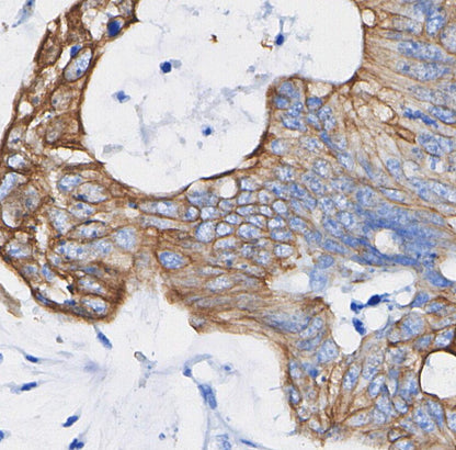 FGF Receptor 2 Antibody