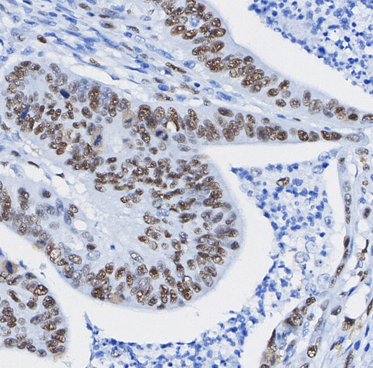 MTA1 Antibody