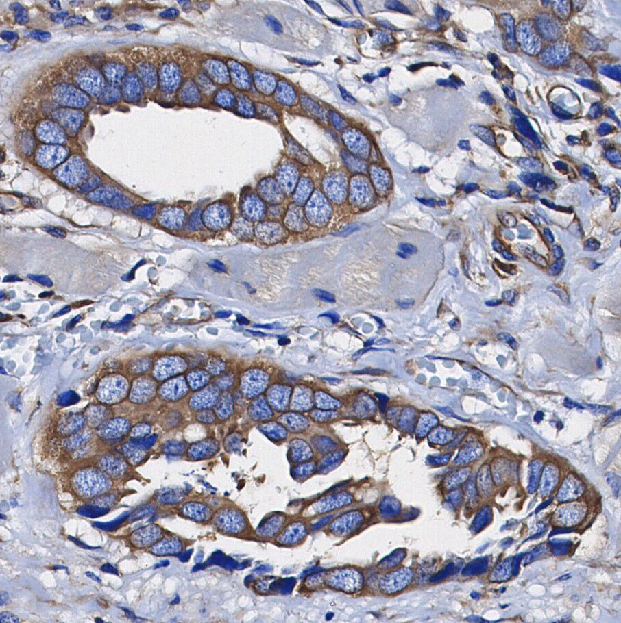 PP2A B Subunit Antibody
