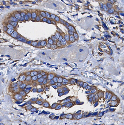 PP2A B Subunit Antibody