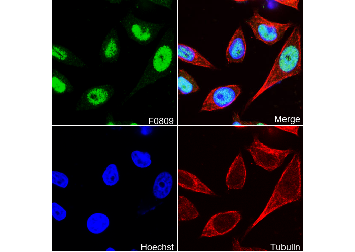 Progesterone Receptor B Antibody