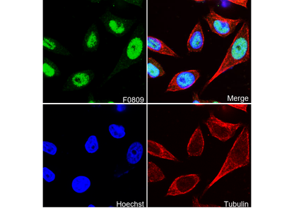 Progesterone Receptor B Antibody