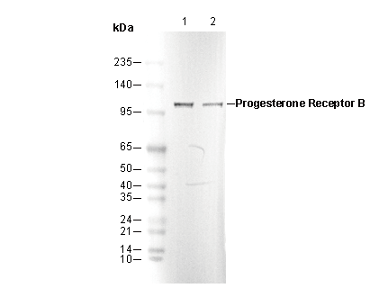 Progesterone Receptor B Antibody