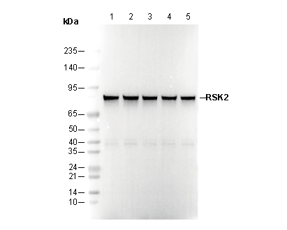 RSK2 Antibody