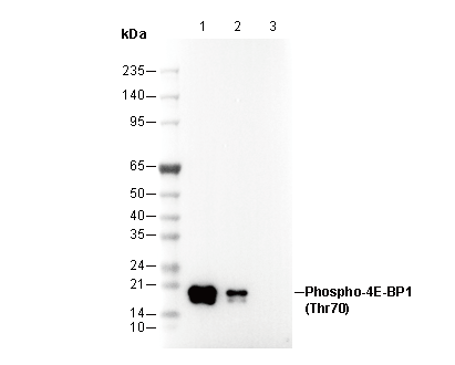 Phospho-4E-BP1 (Thr70) Antibody