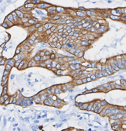 B7-H3 Antibody
