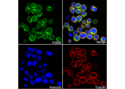 PKCθ Antibody