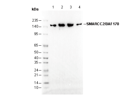 SMARCC2/BAF170 Antibody