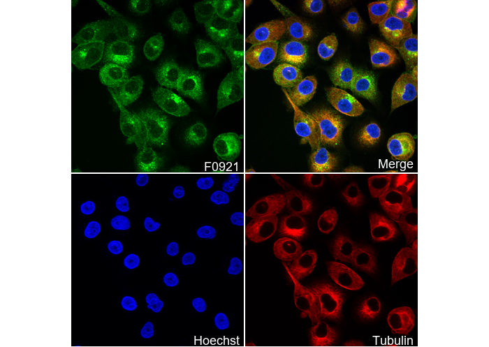 β2-microglobulin Antibody