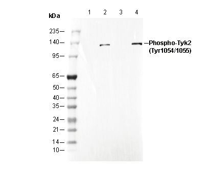 Phospho-Tyk2 (Tyr1054/1055) Antibody