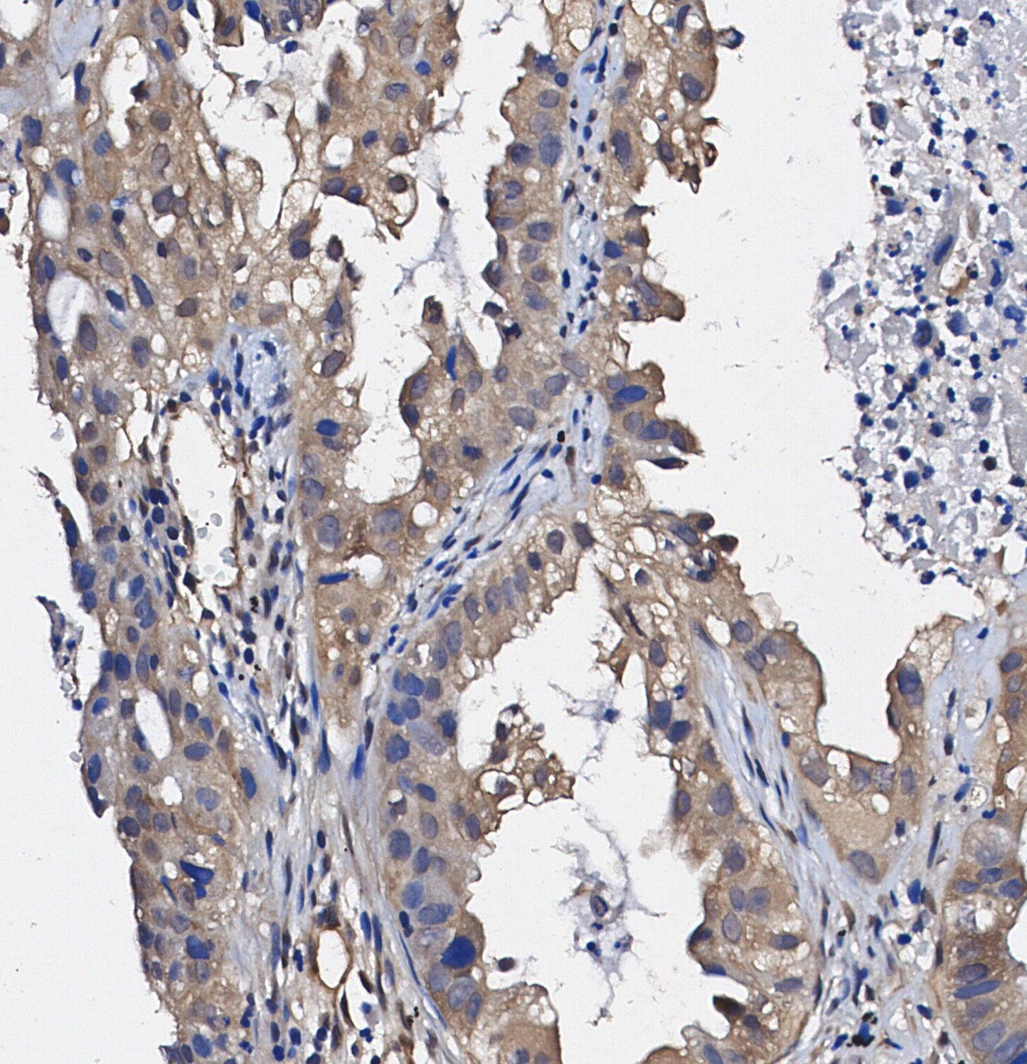 EB1 Antibody