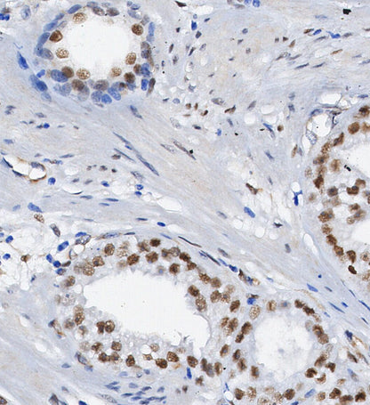 HMGB2 Antibody