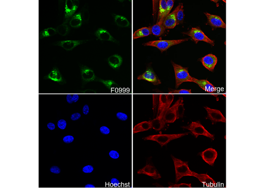 Lipocalin-2 / NGAL Antibody