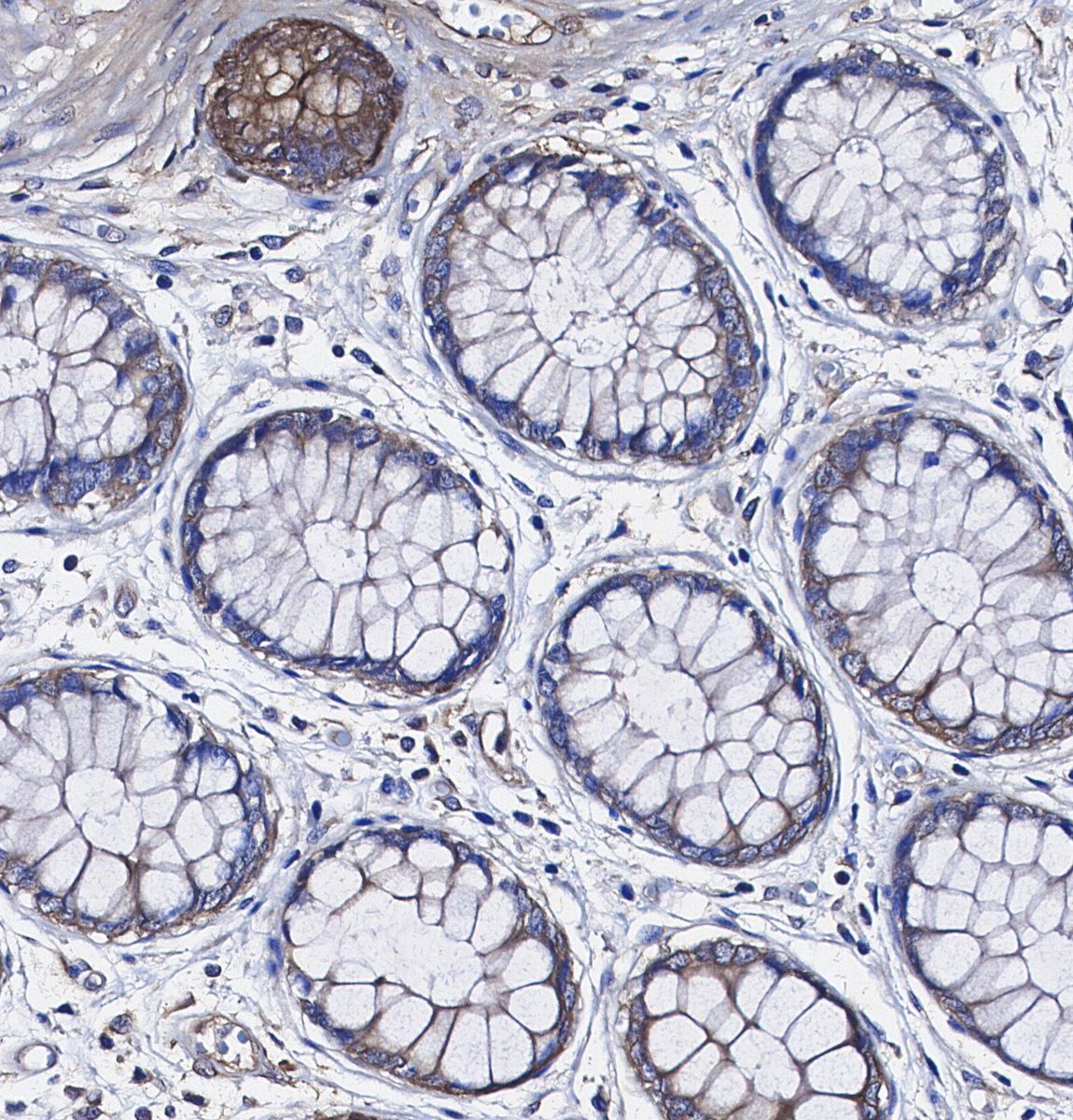 Lipocalin-2 / NGAL Antibody