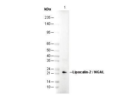Lipocalin-2 / NGAL Antibody