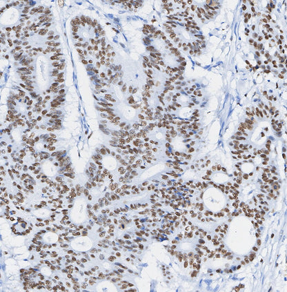 METTL3 Antibody