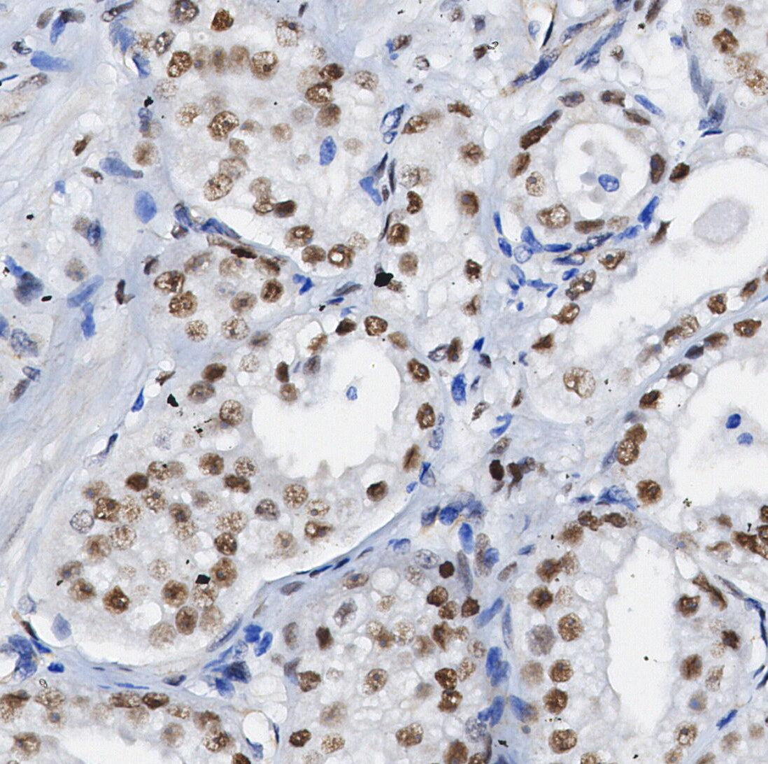 MLH1 Antibody