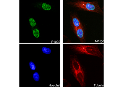 MSH6 Antibody