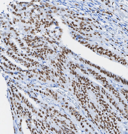 MSH6 Antibody