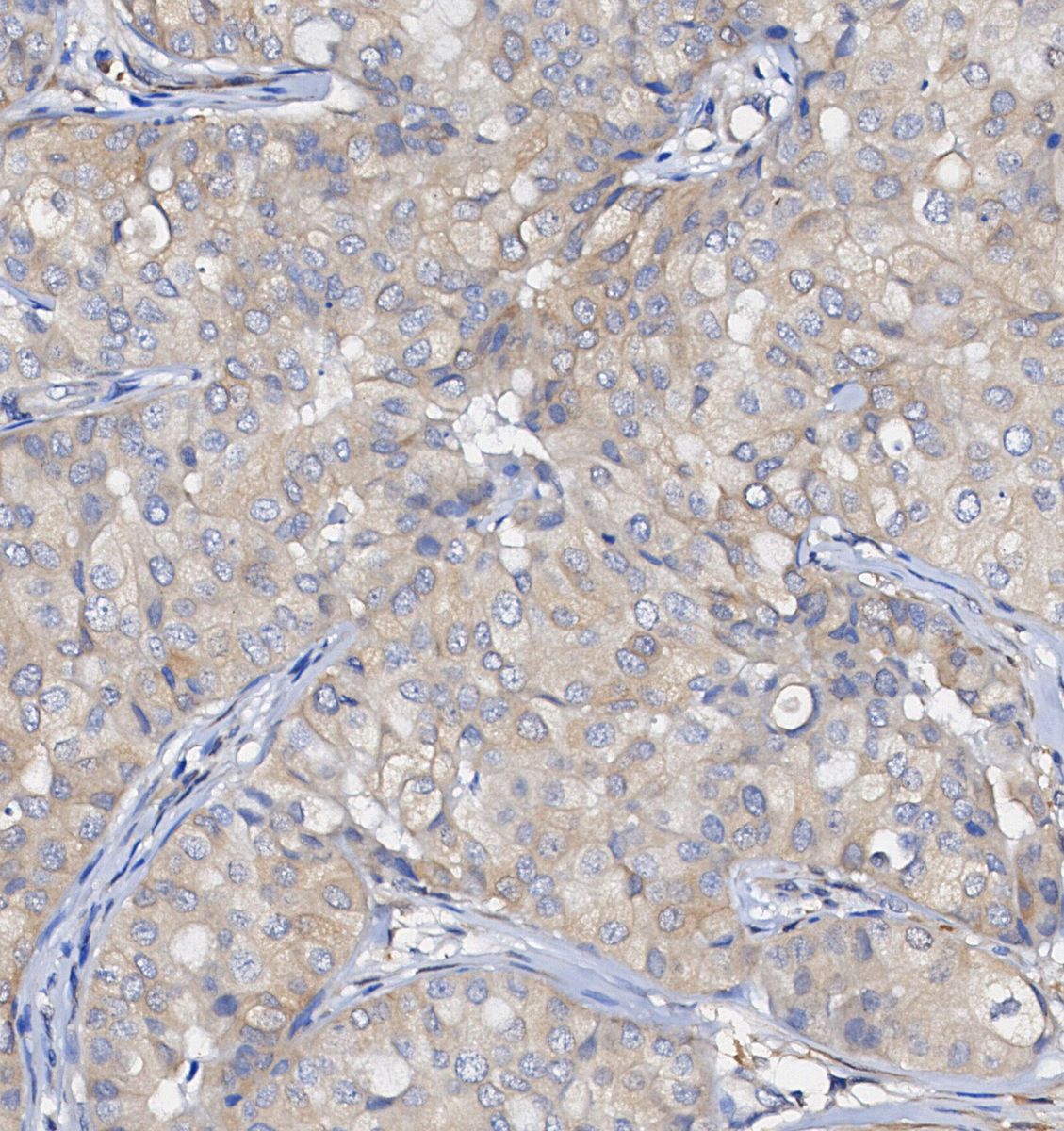 PCK2 Antibody