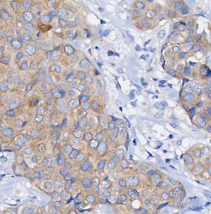 RENT1/hUPF1 Antibody