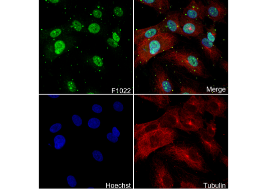 5 Lipoxygenase/5-LO Antibody