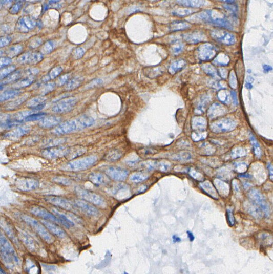 DPP4 Antibody