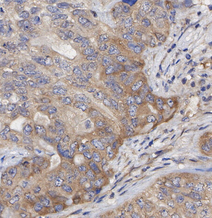 M6PR (cation independent) Antibody